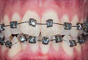 Dentist in North Miami